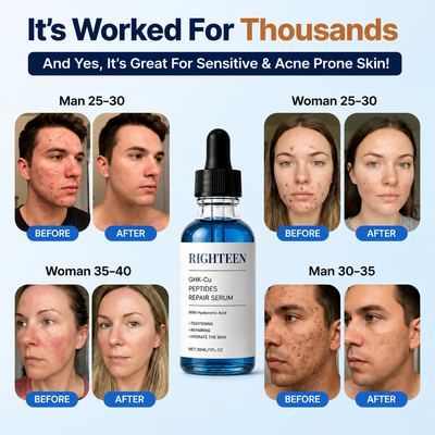 GHK-Cu Peptides Repair Serum